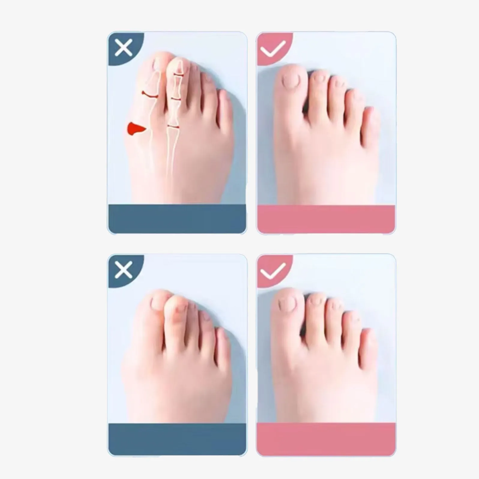 Feral Walk™ Silicone Toe Separator